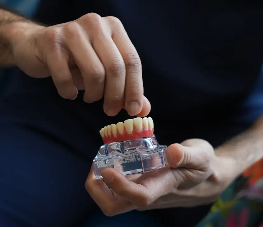 dental implant fitting procedure